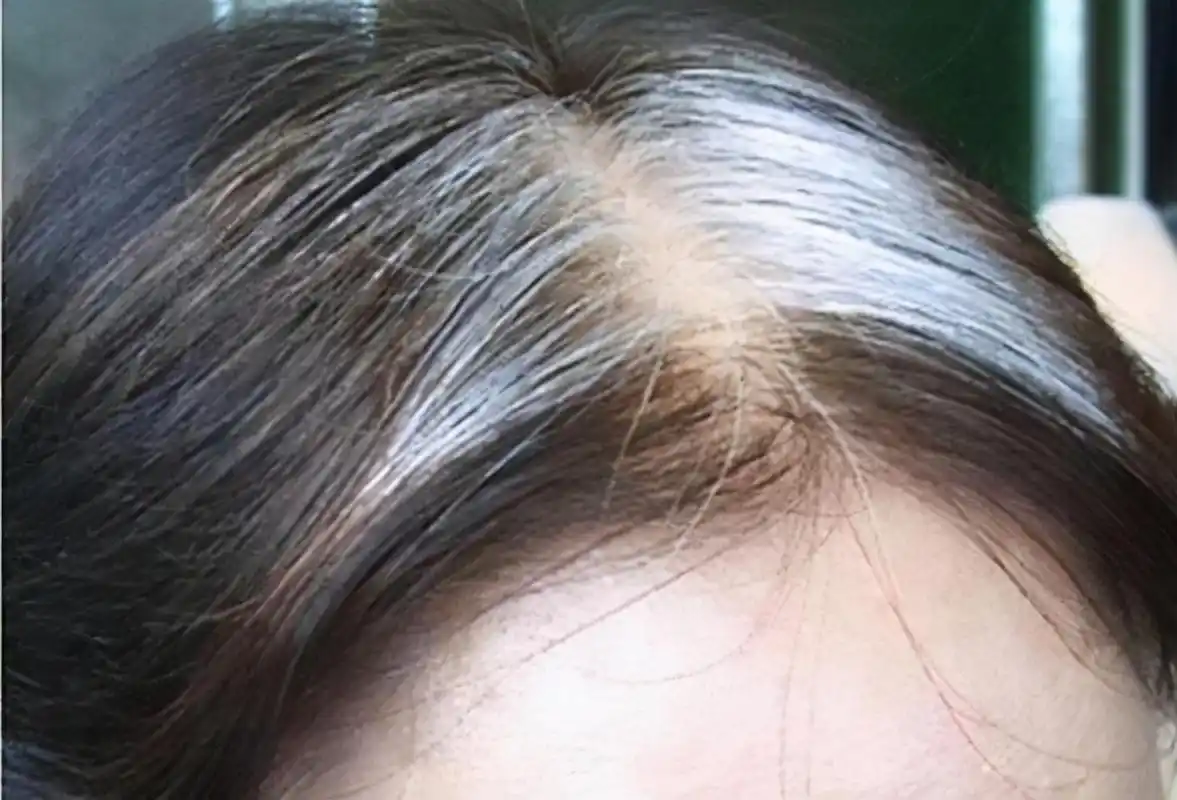 白发长在前额,两鬓,后脑勺,分别有啥含义?早知早好