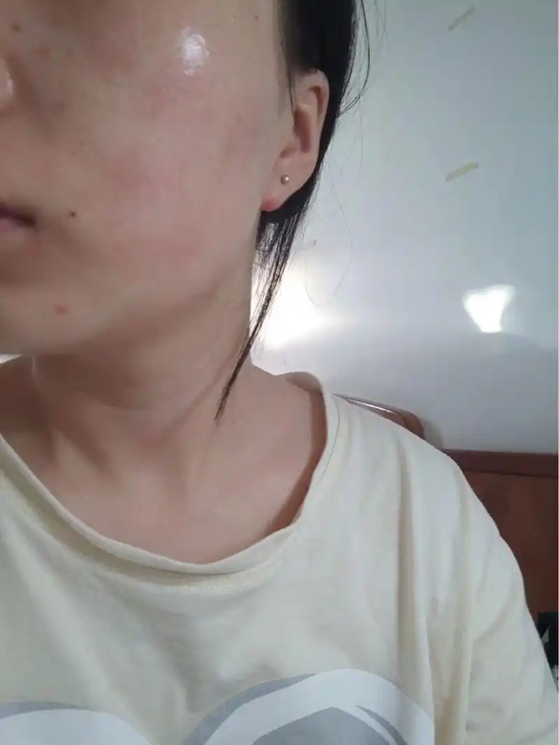 刚用几天,这两天发现一抹上双抗脸就发红发痒,抹其他的没事.