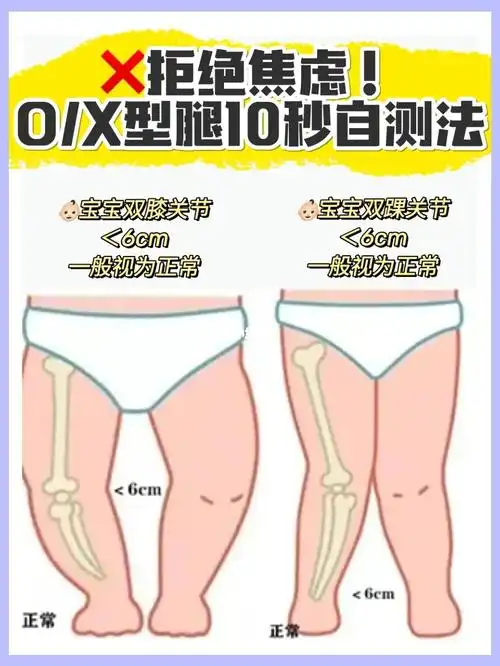 74告别焦虑秒自测宝宝是哪种腿型71