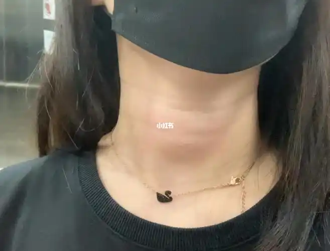 女生喉结