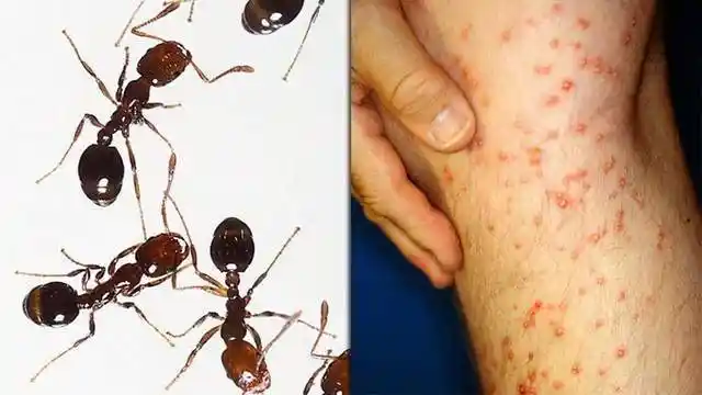 红火蚁对人具有主动攻击性以及重复蜇刺的能力,一旦被蜇伤,毒囊中毒液