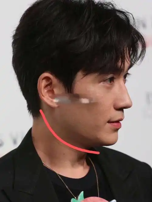 下颌线不清晰,侧脸看起来老十岁!