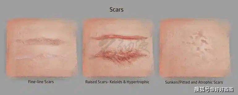 不同类型的伤疤画法教程