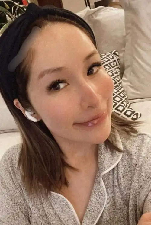 萧亚轩晒精致怼脸自拍 大方露出被狗咬伤疤痕