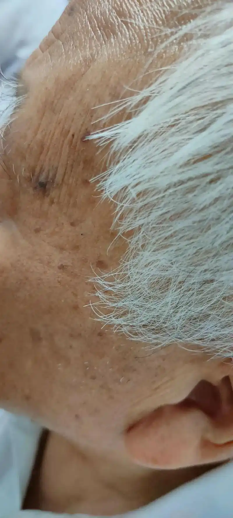 老年癍,妊娠癍,汗斑,色沉癍,日晒!纯植物精华,消癍精油.是 - 抖音