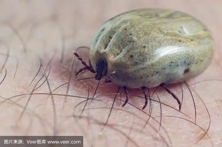 人皮肤上长满血的蜱虫