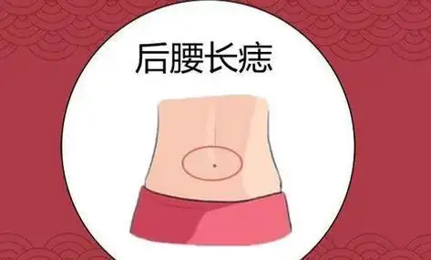 人背痣穷一生是指哪里,背部长痣都有哪些寓意 人背痣穷一生