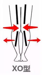 想要修炼成莫文蔚这样的腿精xo型腿靠拢矫正腿还能细了