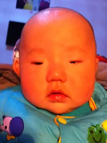 宝宝眼睛这么小怎么办怎么回事