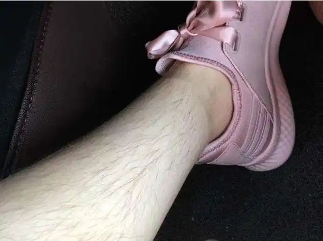 女生体毛多(女生体毛多是不是雌性激素不够)