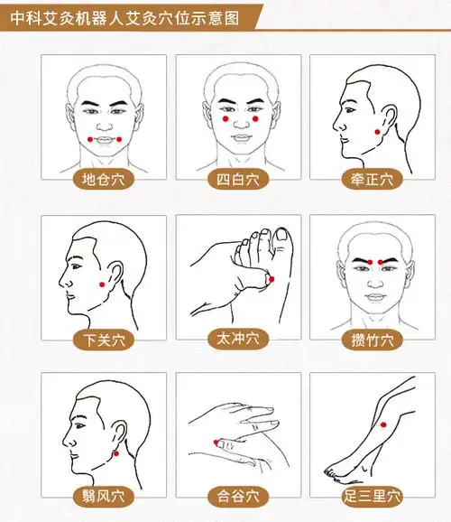 面瘫怎么办,中科艾灸有办法