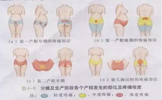 第二产程产妇明显会感觉到会阴,大腿,小腿等部位疼痛明显;而第三产程