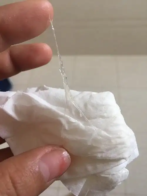 白带拉丝后多就会排卵吧!排卵期