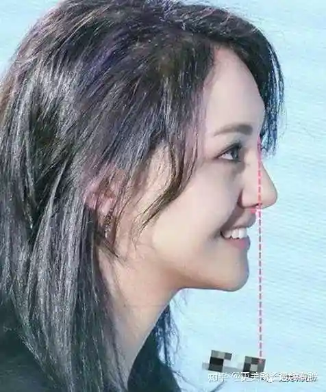 好看的侧脸要符合哪些条件?