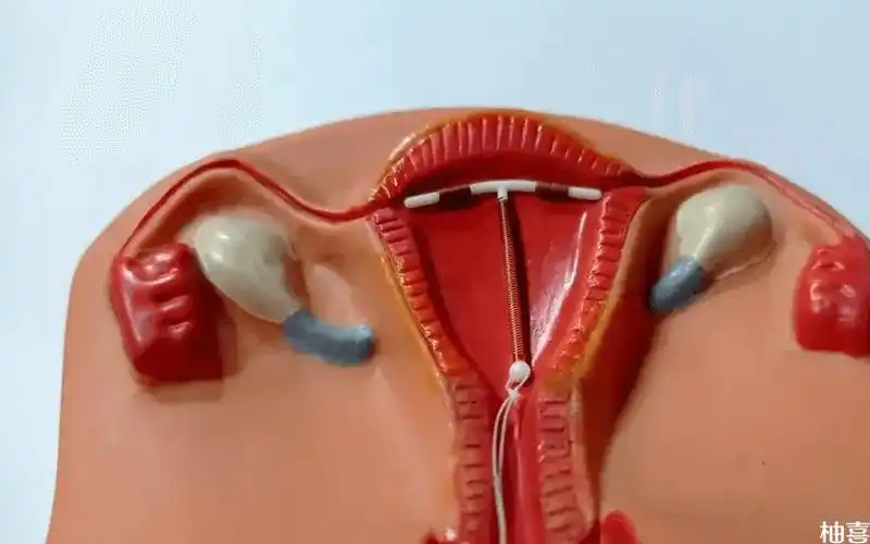 吉妮环避孕效果评测过来人经验告诉你好不好