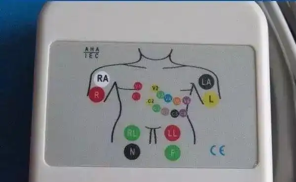 心电监护仪三导联与五导联有何区别及意义