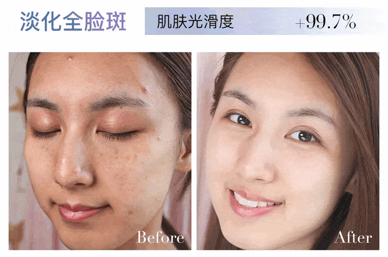 异)▲部分志愿者效果追踪反馈专业仪器监测结果显示:这些彻底淡斑的人