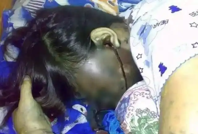 少女手机边充电边用耳机听音乐惨遭触电而死耳机融化在耳朵里