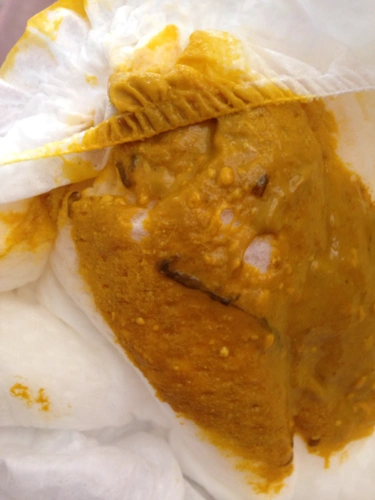 宝宝大便,急急急(图片挺恶心不好意思)