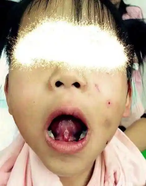 4岁女孩遭暴力伤害遍体鳞伤让人心痛