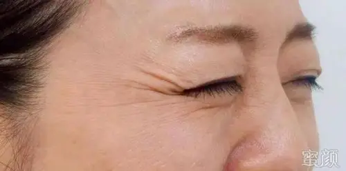 抬头纹     微微一笑     露出尴尬笑纹     鱼尾纹     稍一凝神