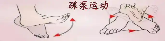 要适当下床运动,保持良好的饮食习惯,有足够的饮水量,多进行踝泵运动