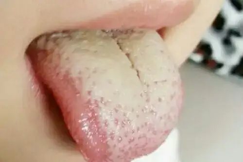 教你如何辨别宝宝积食