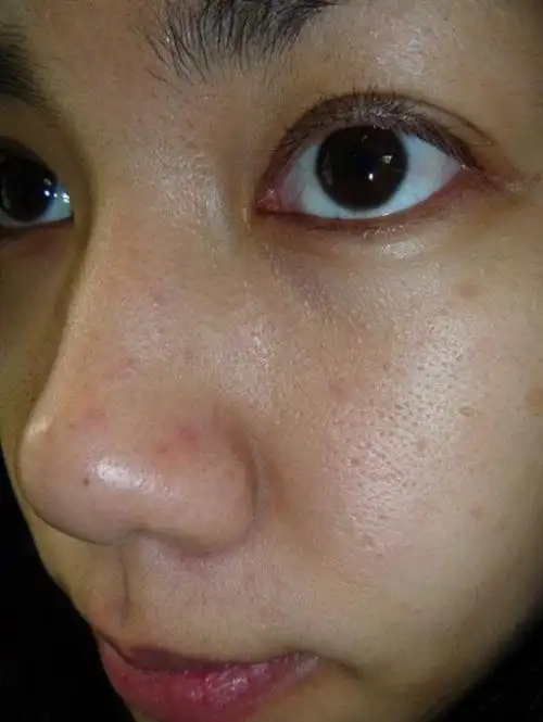 皮肤粗糙是什么原因皮肤粗糙多半跟6个原因有关系