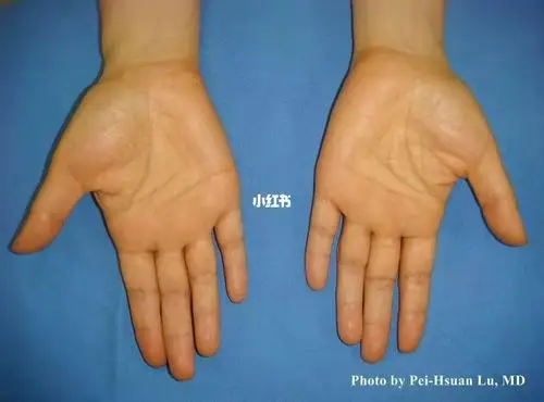 胡萝卜素_黄疸_橙子_内分泌_防晒_保湿护肤_美妆_护肤