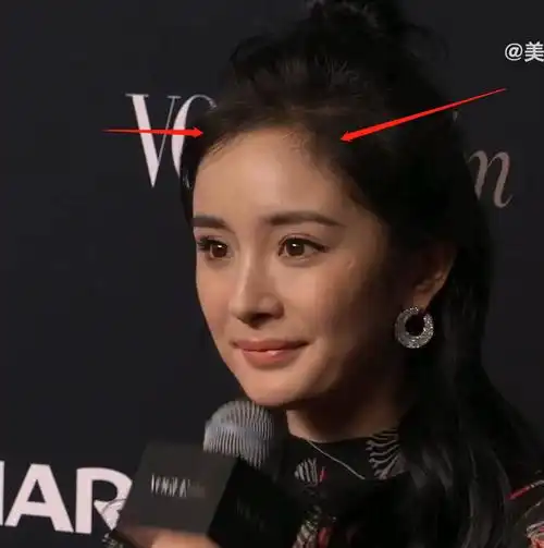 发际线岌岌可危的明星:唐嫣杨幂脑门光秃,鞠婧祎王一博阴影粉遮