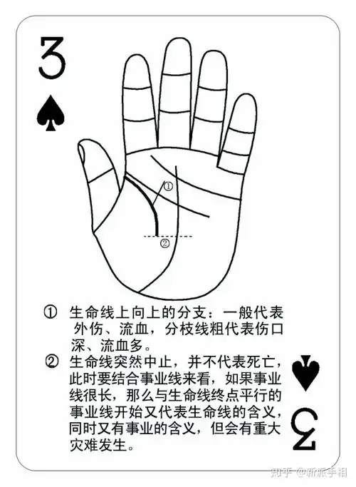 有流血性外伤的手相