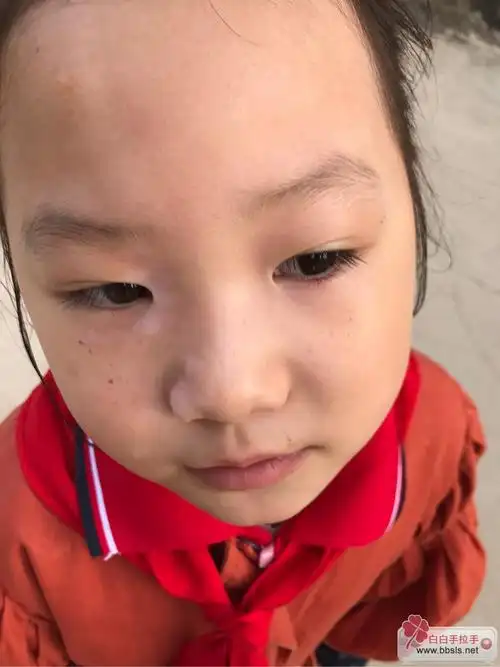 亦宁傅士帮我看看小孩子脸上长了好多黑点点怎么回事会自己消失吗