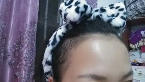 有额头两边的鬓角头发又短又稀疏,有没有什么药能让头发长变密呢?