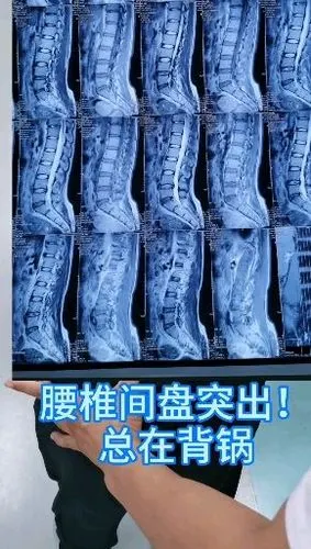 公司 创始人 67关注田医生教大家预防办公室职业病 久坐腰肌无力,腰
