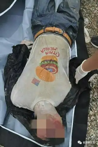 5cm,头面部腐败严重呈"巨人观", 衣着完整,尸体无明显