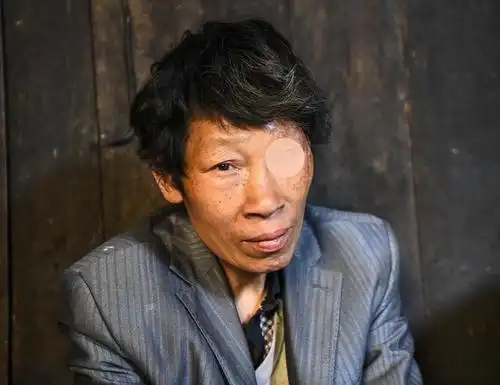 妻子双目失明,丈夫一只眼睛,俩孩子3000度近视,一家渴望光明