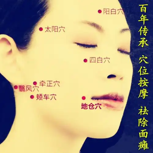 面瘫后遗症面肌痉挛僵硬麻木大小脸口眼联动嘴歪眼斜穴位按摩图