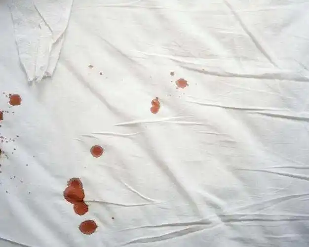 女人若反复有2异常或是感染hpv了医生3种男友别靠太近