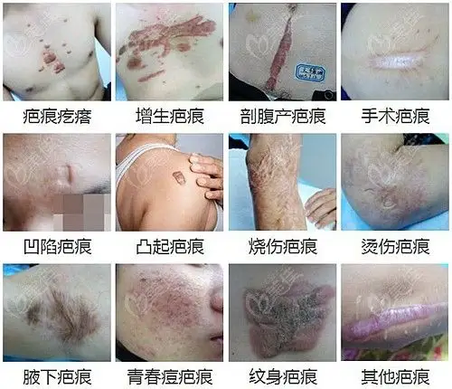 南阳市去疤痕口碑好的医院我找到了这五家其中有两家还是公办的