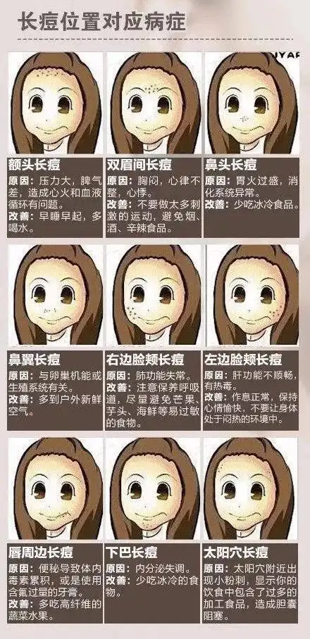 生活| 关于挤痘这件事,这些地方绝对不要轻易下手!_痘痘