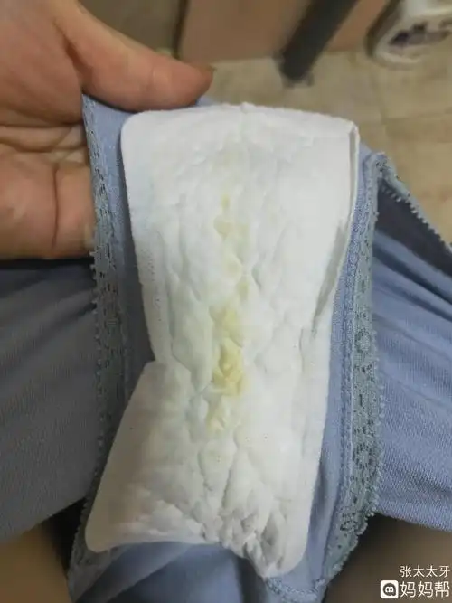 怀孕初期多久白带增多 怀孕多久白色分泌物增多