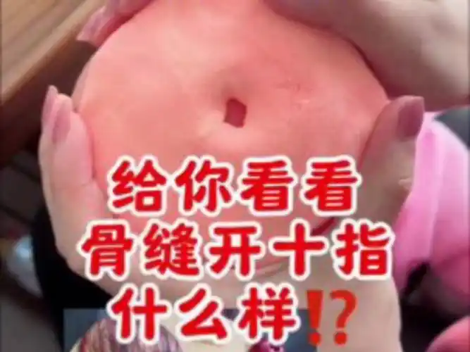 分娩时开十指究竟有多大,妈妈们辛苦了
