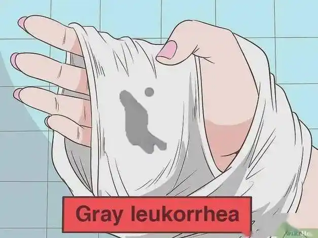 03 咖啡色白带出现咖啡色,说明有出血的情况一些女性会在排卵期的时候