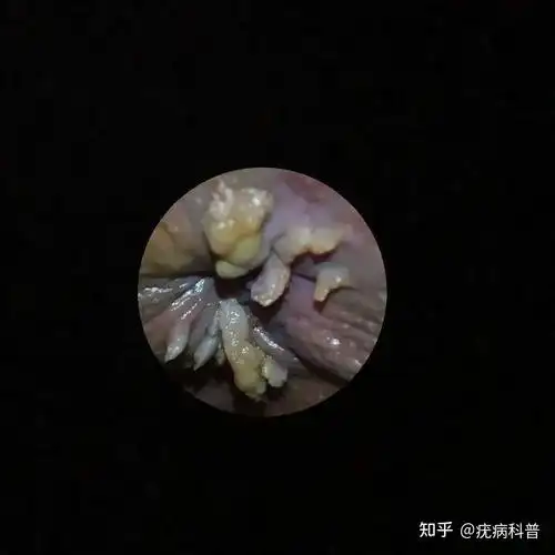 12种疣体图片和介绍-168同城