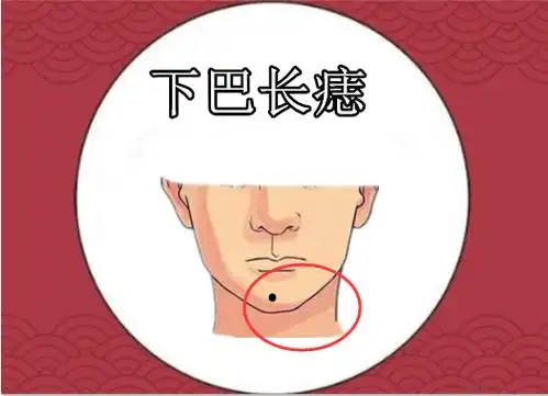 的不好事情就越明显8下巴长痣代表家庭环境不稳定,女人容易有男人引诱