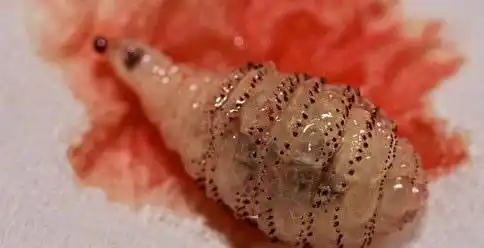 牙齿里取出活虫图片 蛀虫,牙齿里取出活虫图片 拿出来_竞价网