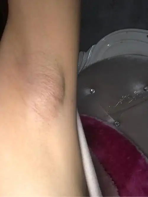 最近腋下长得有像肿块的东西 | 妈妈网轻聊_千万女人的共同选择