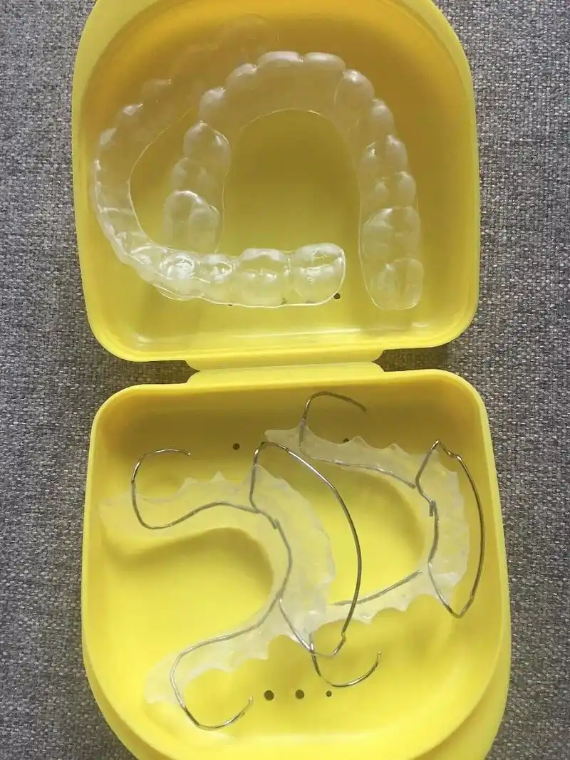 牙套整牙后透明保持器和哈雷保持器对比分享 95拆牙套8年,现在只是