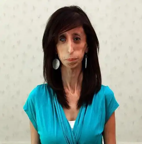 世界最丑女人拍纪录片 以笑脸应对恶言