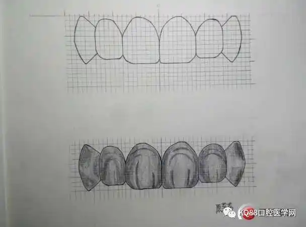 如何一步步做好牙齿充填,做一名优秀的口腔医生